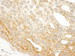 ABCF1 Antibody, Novus Biologicals 0.1mL; Unlabeled:Antibodies, Polyclonal